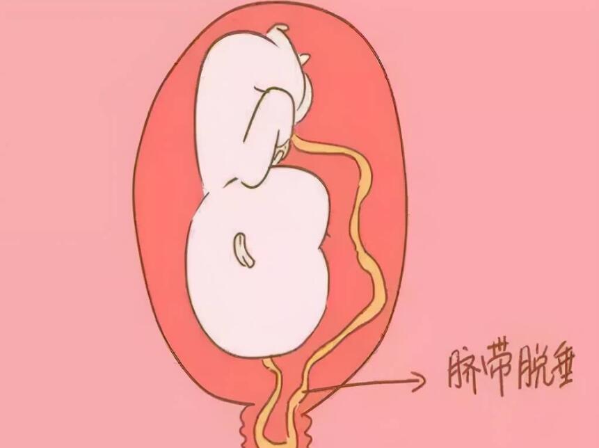 QQ截图20231128152744.jpg